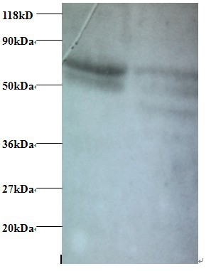 C-C motif chemokine 5 Polyclonal Antibody