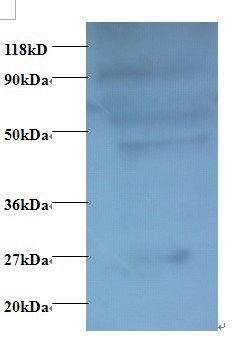 C-C motif chemokine 7 Polyclonal Antibody