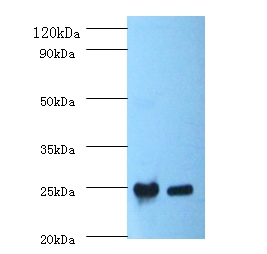 C-reactive protein Polyclonal Antibody