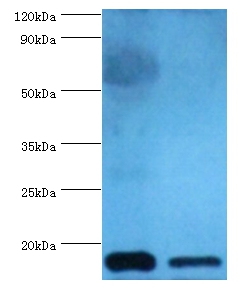 Cystatin-C Polyclonal Antibody