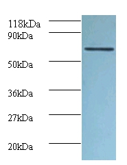 Tumor necrosis factor receptor superfamily member 6 Polyclonal Antibody