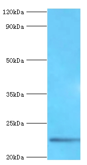 Fibroblast growth factor 21 Polyclonal Antibody