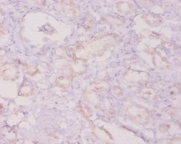 Granulocyte colony-stimulating factor Polyclonal Antibody