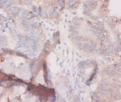 Granulocyte colony-stimulating factor Polyclonal Antibody