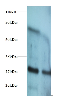 Interferon gamma Polyclonal Antibody