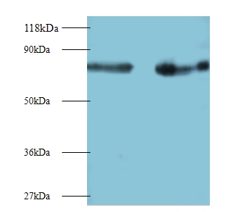 Interleukin-12 subunit beta Polyclonal Antibody