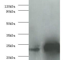 Interleukin-6 Polyclonal Antibody