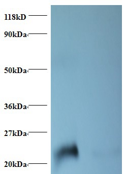 NGAL Polyclonal Antibody