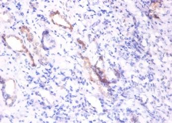 Osteopontin Polyclonal Antibody