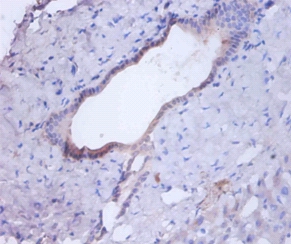 Cathepsin B Polyclonal Antibody