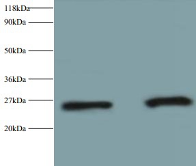 Retinol-binding protein 4 Polyclonal Antibody