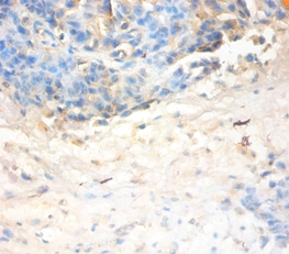 Antileukoproteinase Polyclonal Antibody