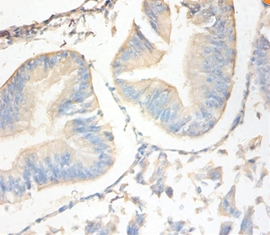 Antileukoproteinase Polyclonal Antibody