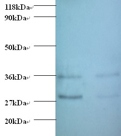 Protransforming growth factor alpha Polyclonal Antibody