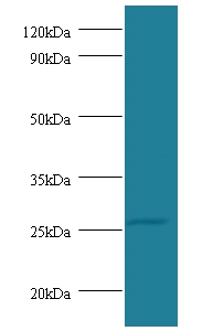 Tumor necrosis factor Polyclonal Antibody