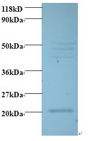 Vascular endothelial growth factor C Polyclonal Antibody