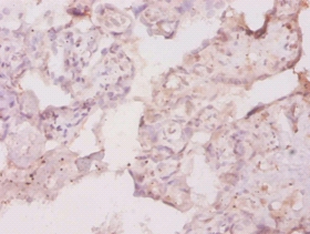 Macrophage colony-stimulating factor 1 receptor Polyclonal Antibody