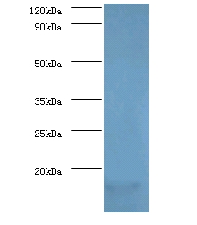 Myelin P2 protein Polyclonal Antibody