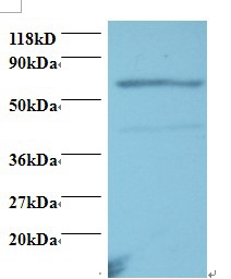 Tumor necrosis factor receptor superfamily member 11A Polyclonal Antibody