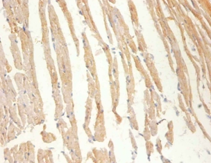 Creatine kinase M-type Polyclonal Antibody