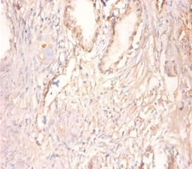 Creatine kinase U-type,mitochondrial Polyclonal Antibody