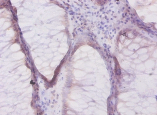 Beta-defensin 1 Polyclonal Antibody