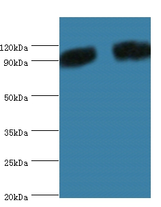 Periostin Polyclonal Antibody