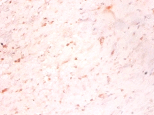 Growth/differentiation factor 15 Polyclonal Antibody