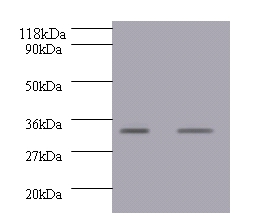 Growth/differentiation factor 15 Polyclonal Antibody