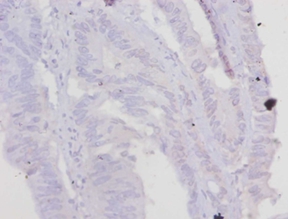 Troponin T, cardiac muscle Polyclonal Antibody