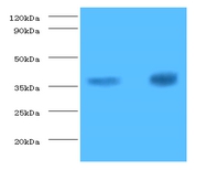 Troponin T, cardiac muscle Polyclonal Antibody