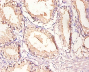 Epidermal growth factor receptor Polyclonal Antibody