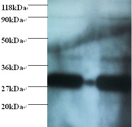 Glutathione S-transferase P Polyclonal Antibody