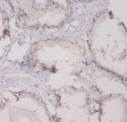 Complement C3 Polyclonal Antibody;