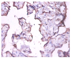 Keratin, type I cytoskeletal 18 Polyclonal Antibody