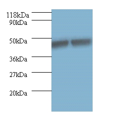 Keratin, type I cytoskeletal 18 Polyclonal Antibody