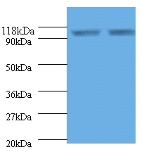 Endoplasmin Polyclonal Antibody