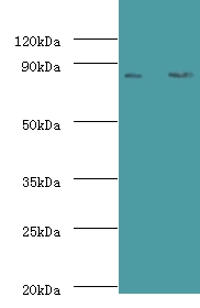 Complement factor B Polyclonal Antibody