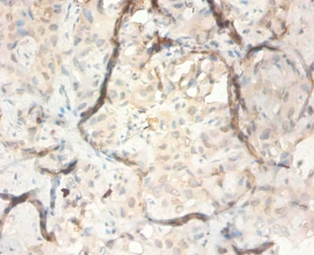 Serpin B3 Polyclonal Antibody