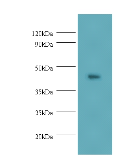 Napsin-A Polyclonal Antibody