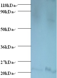 Bis(5'-adenosyl)-triphosphatase Polyclonal Antibody