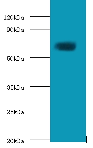 Protein-glutamine gamma-glutamyltransferase 2 Polyclonal Antibody