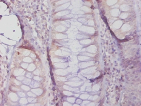 Methylated-DNA--protein-cysteine methyltransferase Polyclonal Antibody