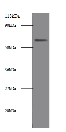 Intestinal-type alkaline phosphatase Polyclonal Antibody