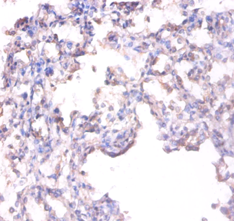 Alkaline phosphatase, tissue-nonspecific isozyme Polyclonal Antibody