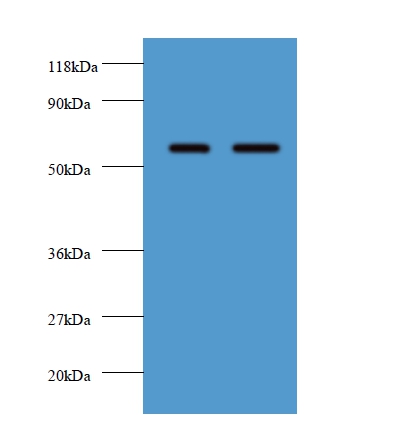 Plasma alpha-L-fucosidase Polyclonal Antibody