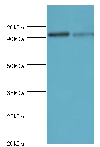 Hypoxia-inducible factor 1-alphaPolyclonal Antibody