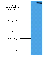 Vinculin Polyclonal Antibody