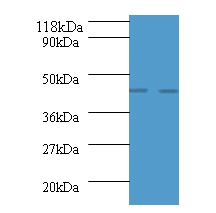 Advanced glycosylation end product-specific receptor Polyclonal Antibody