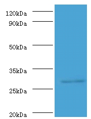 ureA Polyclonal Antibody